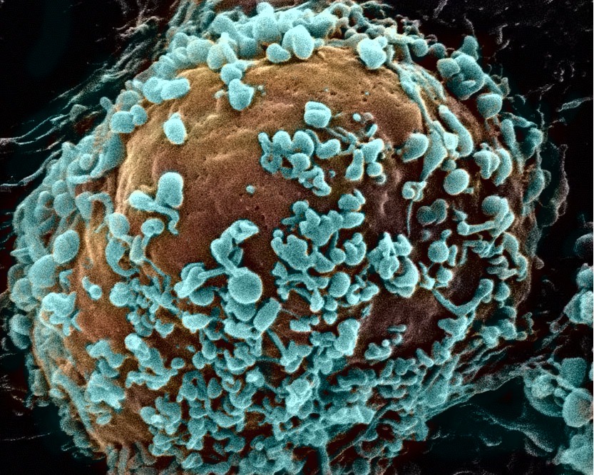 細胞表面から出芽する新型コロナウイルス粒子を走査型電子顕微鏡にて撮影 （出芽の様子を見やすくするためにウイルス粒子をコンピューター上で青く着色しています）